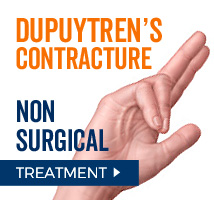 Non-surgical treatment for Dupuytren's Constricture