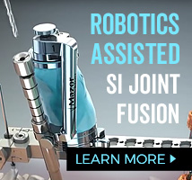 SI Joint Fusion using Mazor Robotics Renaissance Guidance System